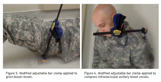 Illustration for article titled How Combat Medicine is Fighting to Keep More Troops Alive